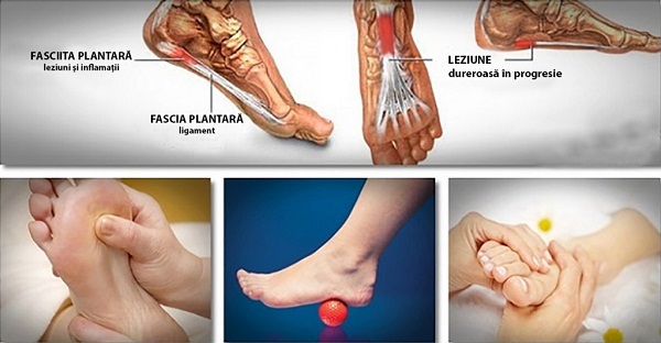 exerciții împotriva durerilor de șold cum să îndepărtați umflarea din articulația gleznei
