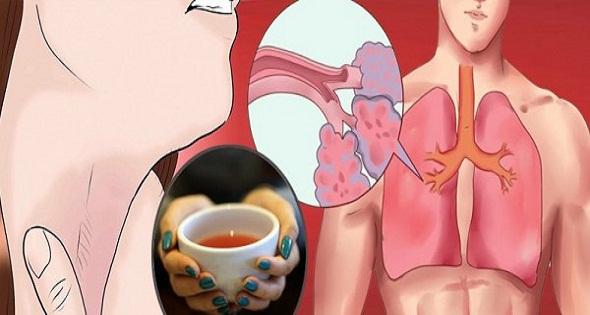ceai pentru eliminarea mucusului din plamani hpv that causes cancer