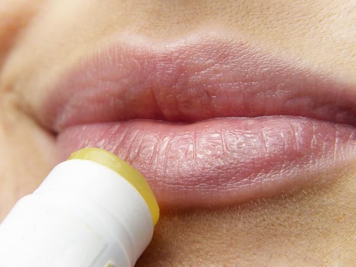 remediu pentru herpes